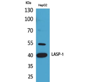 Western blot - LASP-1 Polyclonal Antibody from Signalway Antibody (41642) - Antibodies.com