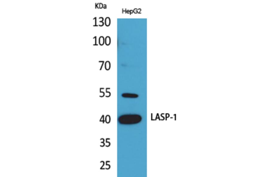 Western blot - LASP-1 Polyclonal Antibody from Signalway Antibody (41642) - Antibodies.com