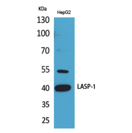 Western blot - LASP-1 Polyclonal Antibody from Signalway Antibody (41642) - Antibodies.com