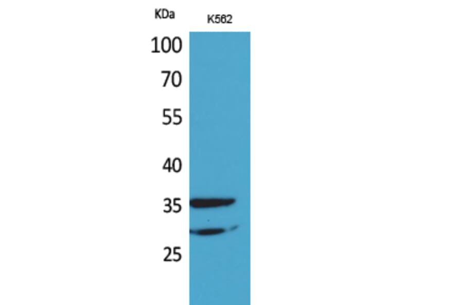 Western blot - IL-2Rα Polyclonal Antibody from Signalway Antibody (41650) - Antibodies.com