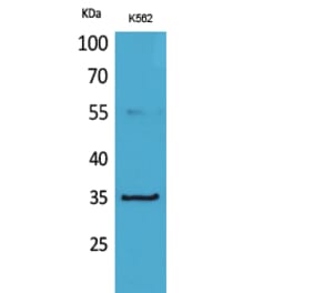 Western blot - CD32-A Polyclonal Antibody from Signalway Antibody (41652) - Antibodies.com