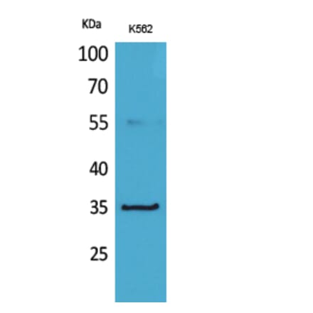 Western blot - CD32-A Polyclonal Antibody from Signalway Antibody (41652) - Antibodies.com
