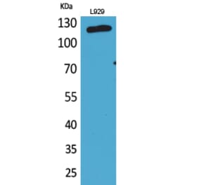 Western blot - CD107a Polyclonal Antibody from Signalway Antibody (41667) - Antibodies.com