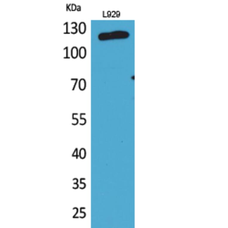 Western blot - CD107a Polyclonal Antibody from Signalway Antibody (41667) - Antibodies.com