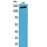 Western blot - CD107a Polyclonal Antibody from Signalway Antibody (41667) - Antibodies.com