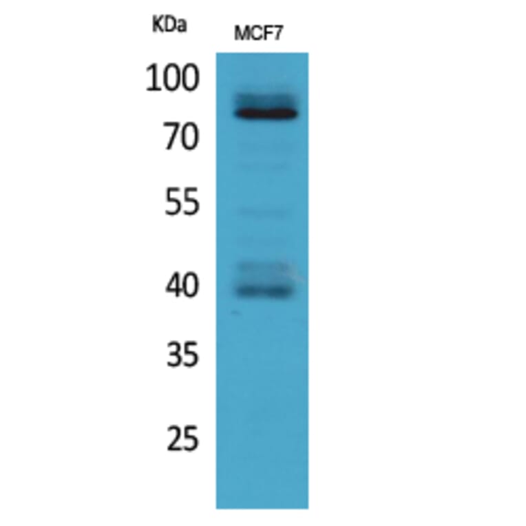 Western blot - IL-1RI Polyclonal Antibody from Signalway Antibody (41670) - Antibodies.com