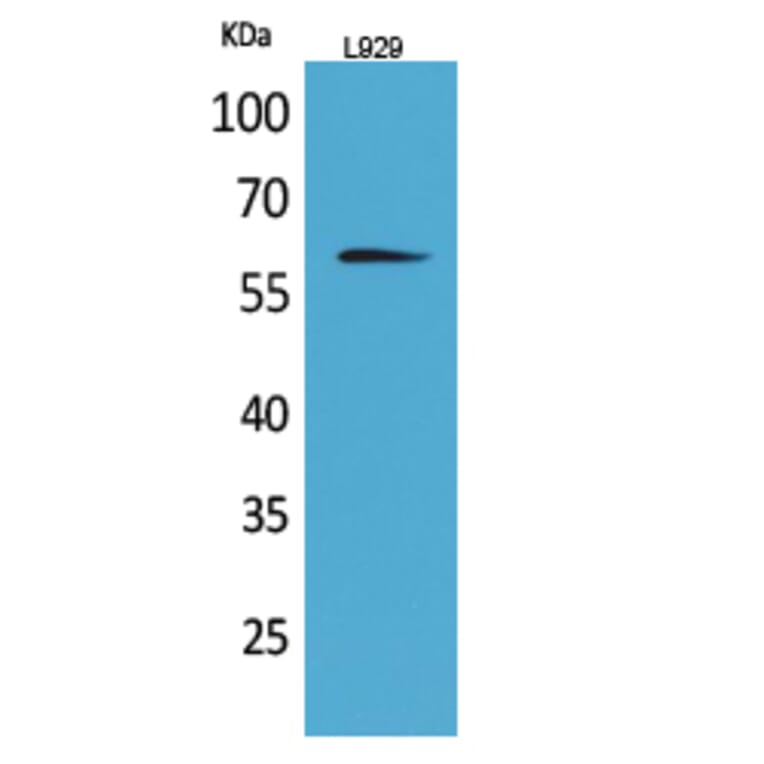 Western blot - IL-2Rβ Polyclonal Antibody from Signalway Antibody (41671) - Antibodies.com