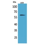 Western blot - IL-2Rβ Polyclonal Antibody from Signalway Antibody (41671) - Antibodies.com