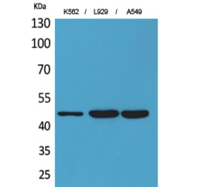 Western blot - CD158z Polyclonal Antibody from Signalway Antibody (41680) - Antibodies.com