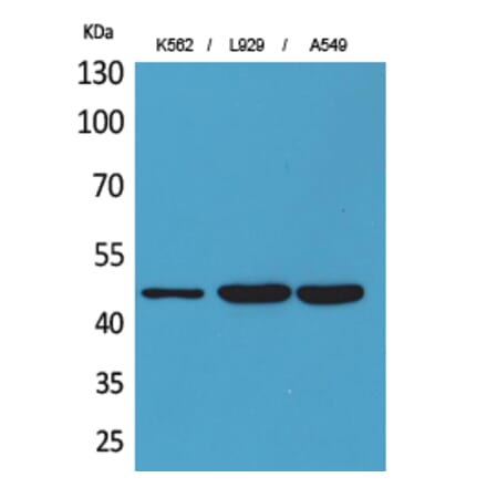 Western blot - CD158z Polyclonal Antibody from Signalway Antibody (41680) - Antibodies.com