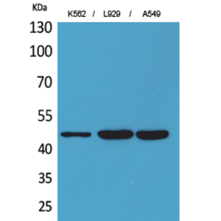 Western blot - CD158z Polyclonal Antibody from Signalway Antibody (41680) - Antibodies.com