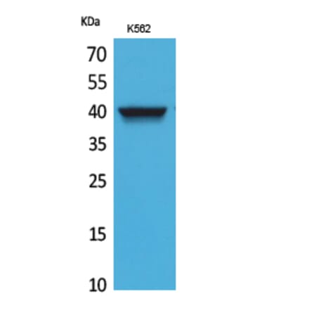 Western blot - CXCR-3 Polyclonal Antibody from Signalway Antibody (41683) - Antibodies.com