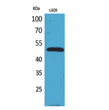 Western blot - VEGF-C Polyclonal Antibody from Signalway Antibody (41702) - Antibodies.com