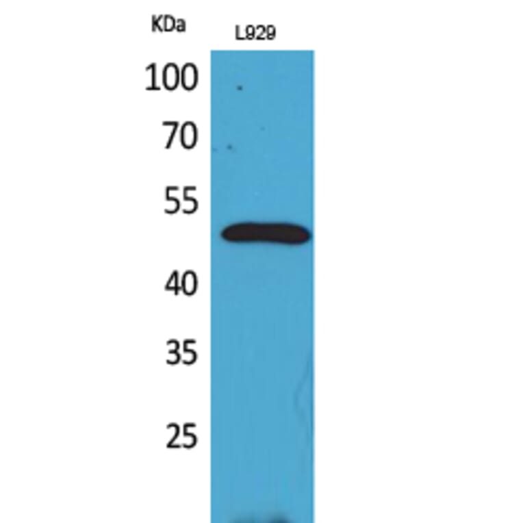 Western blot - VEGF-C Polyclonal Antibody from Signalway Antibody (41702) - Antibodies.com
