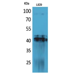 Western blot - PDGF-D Polyclonal Antibody from Signalway Antibody (41704) - Antibodies.com