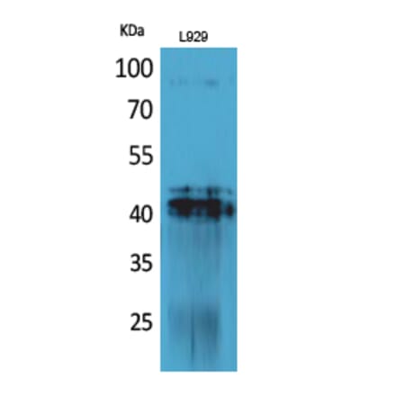 Western blot - PDGF-D Polyclonal Antibody from Signalway Antibody (41704) - Antibodies.com