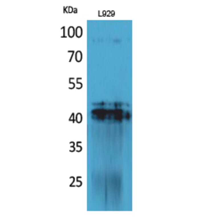 Western blot - PDGF-D Polyclonal Antibody from Signalway Antibody (41704) - Antibodies.com