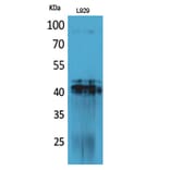 Western blot - PDGF-D Polyclonal Antibody from Signalway Antibody (41704) - Antibodies.com