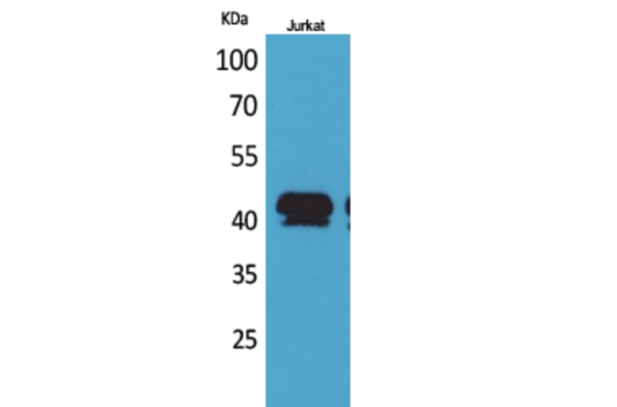 Western blot - BMP-8A Polyclonal Antibody from Signalway Antibody (41708) - Antibodies.com