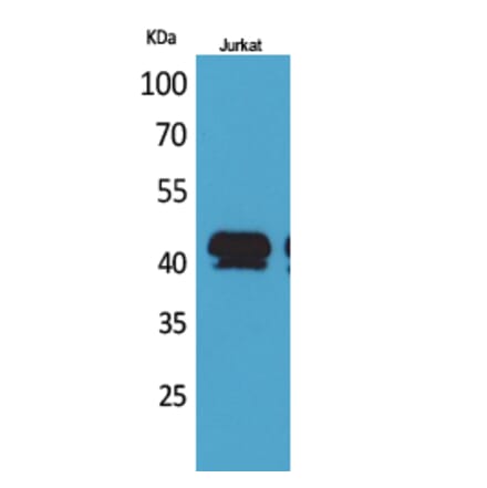 Western blot - BMP-8A Polyclonal Antibody from Signalway Antibody (41708) - Antibodies.com