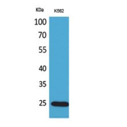 Western blot - IGFBP6 Polyclonal Antibody from Signalway Antibody (41750) - Antibodies.com