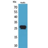 Western blot - CacyBP Polyclonal Antibody from Signalway Antibody (41775) - Antibodies.com