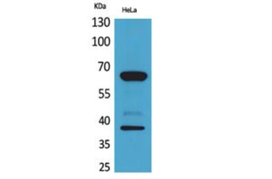 Western blot - DNAM-1 Polyclonal Antibody from Signalway Antibody (41787) - Antibodies.com