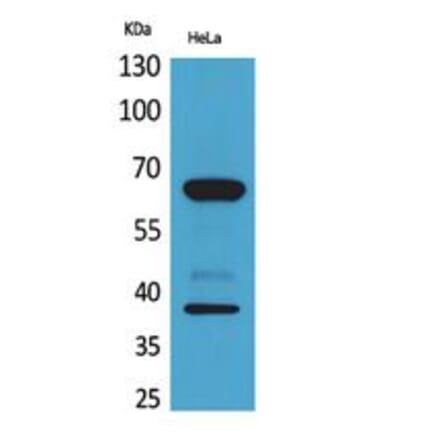 Western blot - DNAM-1 Polyclonal Antibody from Signalway Antibody (41787) - Antibodies.com