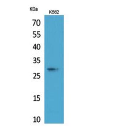 Western blot - ApoA-I Polyclonal Antibody from Signalway Antibody (41817) - Antibodies.com