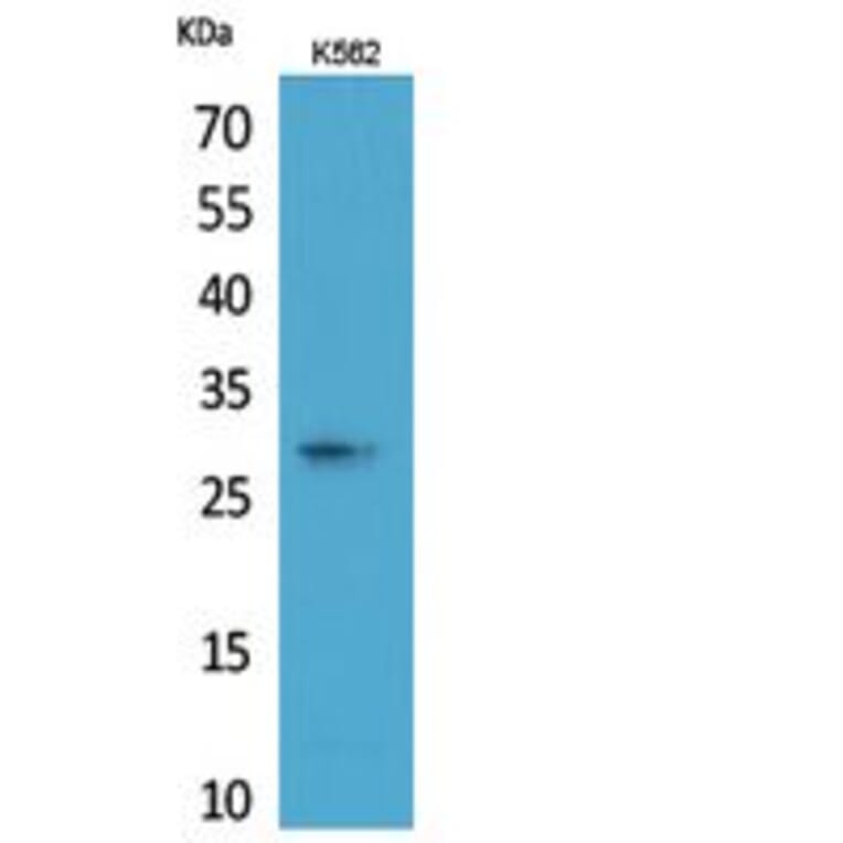 Western blot - ApoA-I Polyclonal Antibody from Signalway Antibody (41817) - Antibodies.com