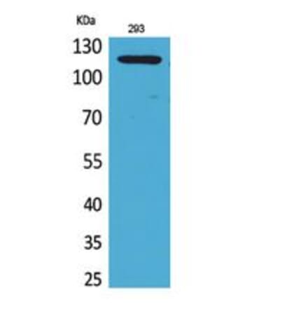 Western blot - SERCA2 Polyclonal Antibody from Signalway Antibody (41825) - Antibodies.com