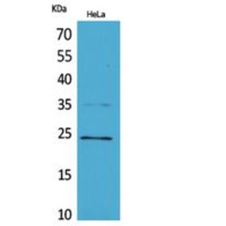 Western blot - Rab 5A Polyclonal Antibody from Signalway Antibody (41829) - Antibodies.com