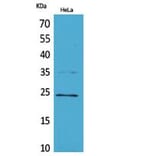 Western blot - Rab 5A Polyclonal Antibody from Signalway Antibody (41829) - Antibodies.com