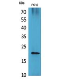 Western blot - VEGF-B Polyclonal Antibody from Signalway Antibody (41857) - Antibodies.com