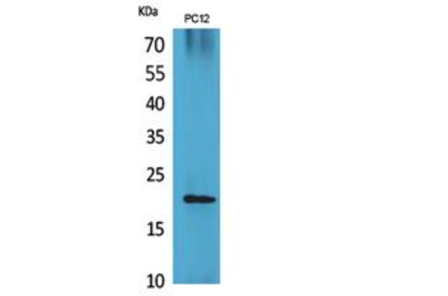 Western blot - VEGF-B Polyclonal Antibody from Signalway Antibody (41857) - Antibodies.com