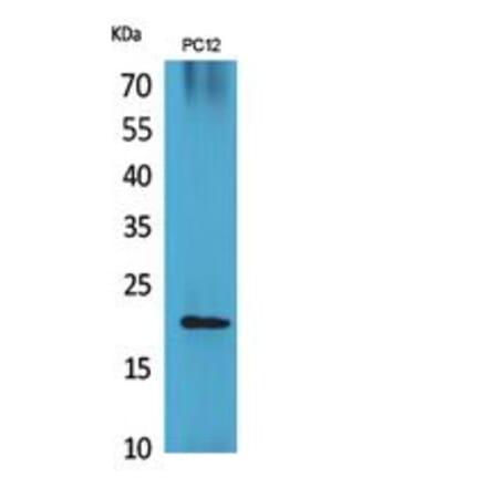 Western blot - VEGF-B Polyclonal Antibody from Signalway Antibody (41857) - Antibodies.com