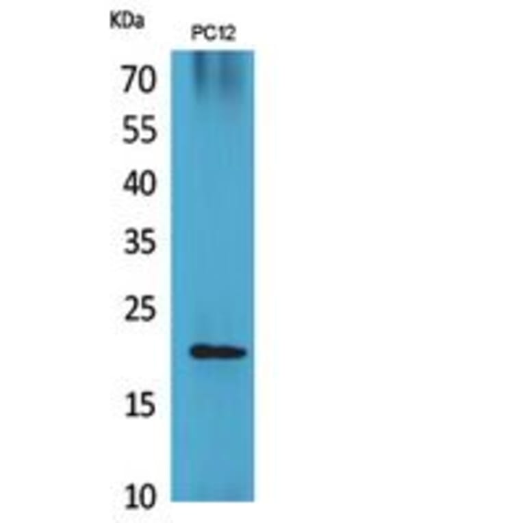 Western blot - VEGF-B Polyclonal Antibody from Signalway Antibody (41857) - Antibodies.com