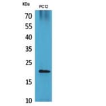 Western blot - VEGF-B Polyclonal Antibody from Signalway Antibody (41857) - Antibodies.com