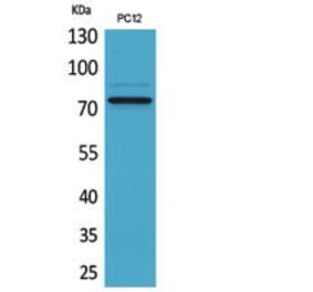 Western blot - SAMHD1 Polyclonal Antibody from Signalway Antibody (41862) - Antibodies.com