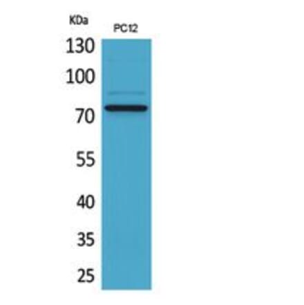 Western blot - SAMHD1 Polyclonal Antibody from Signalway Antibody (41862) - Antibodies.com