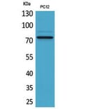 Western blot - SAMHD1 Polyclonal Antibody from Signalway Antibody (41862) - Antibodies.com