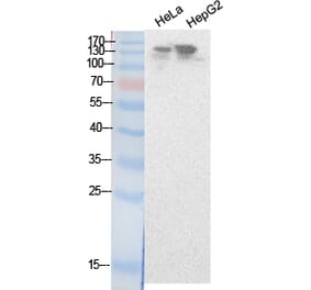 Western blot - NCoA-3 Polyclonal Antibody from Signalway Antibody (41877) - Antibodies.com
