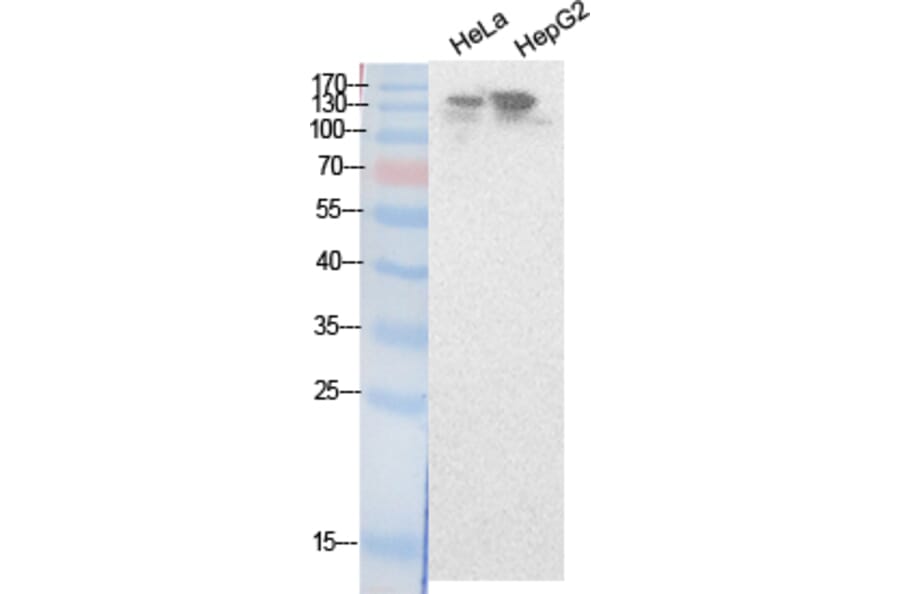 Western blot - NCoA-3 Polyclonal Antibody from Signalway Antibody (41877) - Antibodies.com