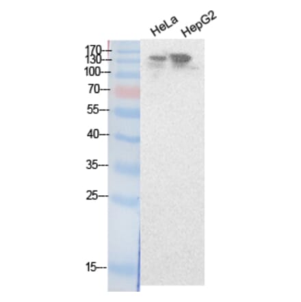 Western blot - NCoA-3 Polyclonal Antibody from Signalway Antibody (41877) - Antibodies.com