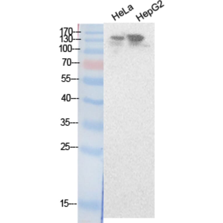 Western blot - NCoA-3 Polyclonal Antibody from Signalway Antibody (41877) - Antibodies.com
