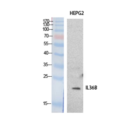 Western blot - IL-1F8 Polyclonal Antibody from Signalway Antibody (41882) - Antibodies.com