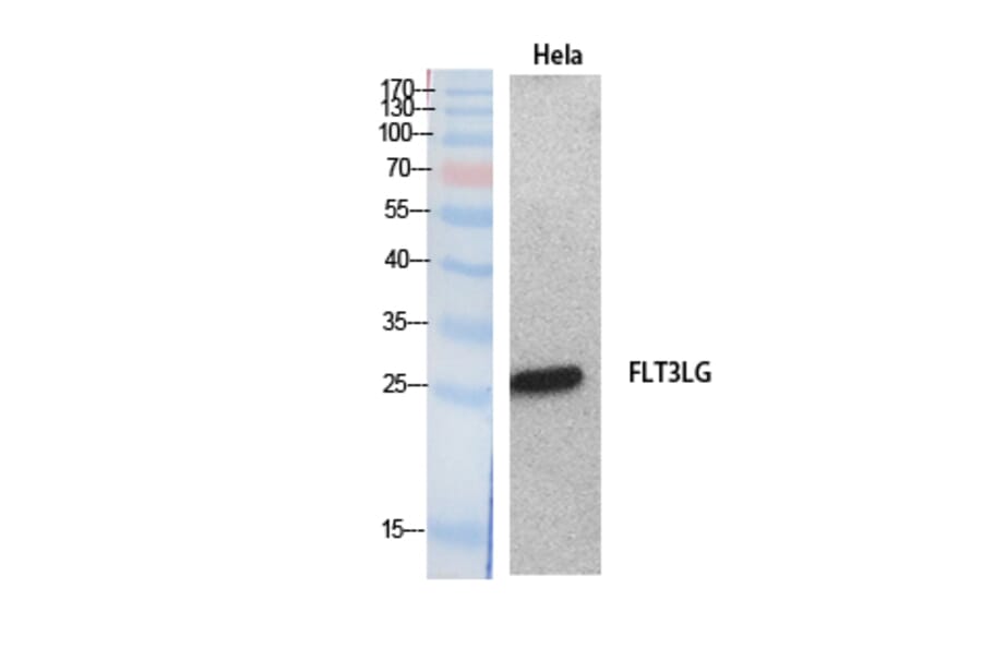Western blot - Flt3-L Polyclonal Antibody from Signalway Antibody (41886) - Antibodies.com