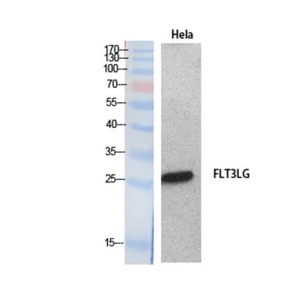 Western blot - Flt3-L Polyclonal Antibody from Signalway Antibody (41886) - Antibodies.com