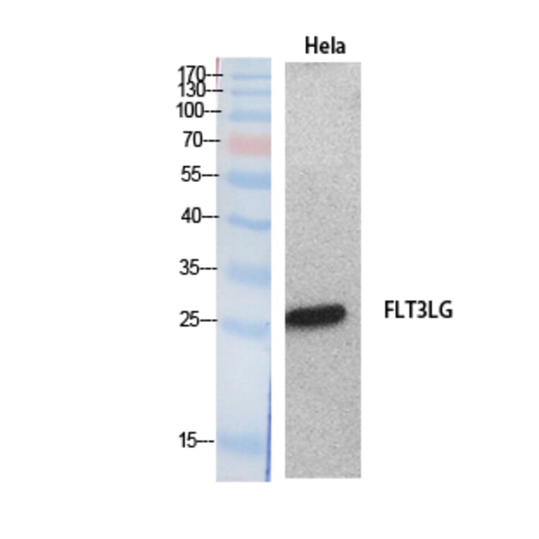 Western blot - Flt3-L Polyclonal Antibody from Signalway Antibody (41886) - Antibodies.com