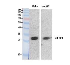 Western blot - IGFBP3 Polyclonal Antibody from Signalway Antibody (41888) - Antibodies.com